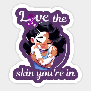 Love The Skin You're In Vitiligo Awareness and Acceptance Sticker